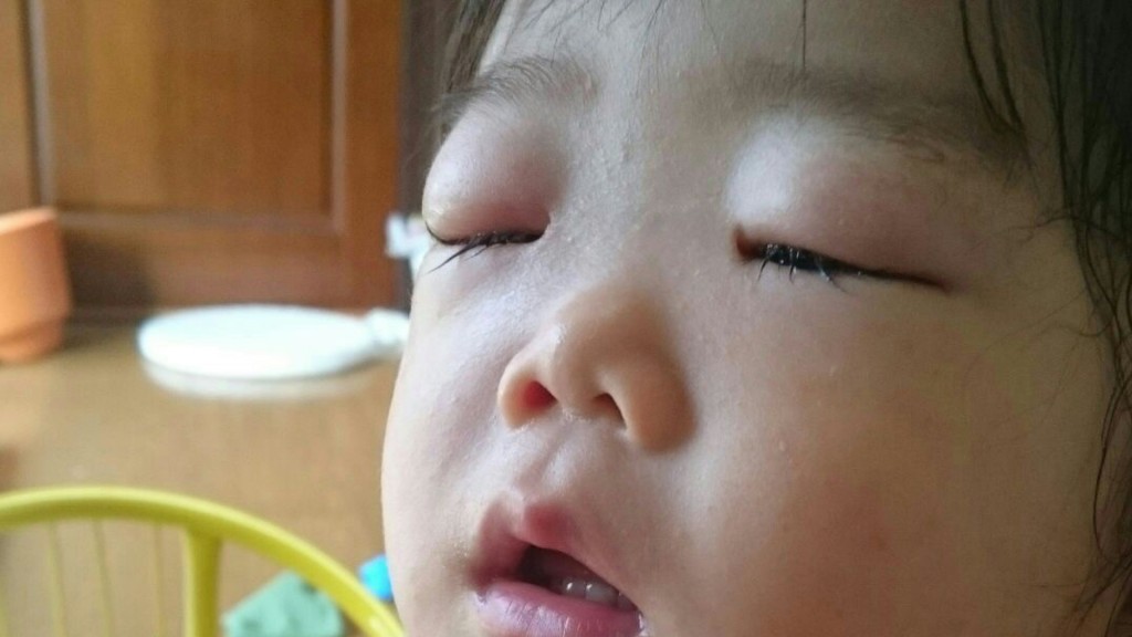 咽頭結膜熱 プール熱 子供 プール熱の症状 潜伏期間 対処方法 感染対策 スクラムちゃんの部屋